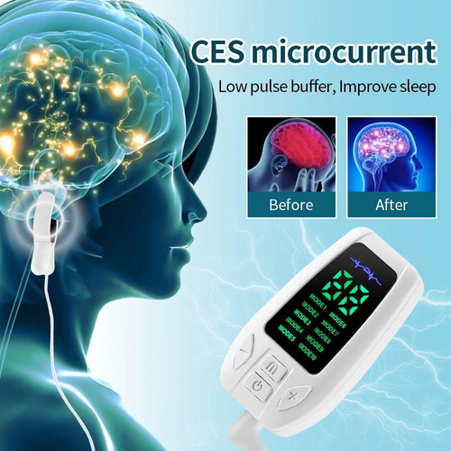 10 Modes Sleep Aid Device Microcurrent CES Sleeping Instrument Insomnia Anxiety Depression Machine Fast Sleeping Health Care - Better World Today